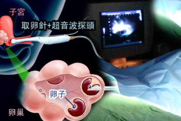 武汉试管助孕热线 目前2023武汉供卵试管婴儿前五排名 ‘4个多月做b超看男女准